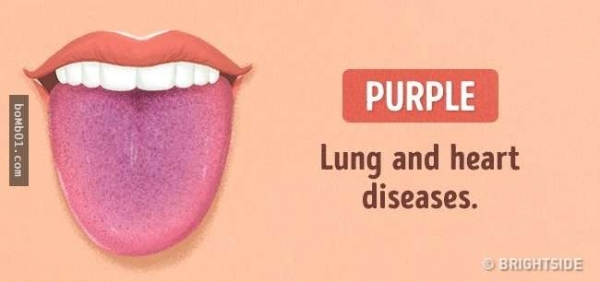 現在伸出你的舌頭就能快速檢測「身體哪裡有毛病」，紫色舌頭的疾病實在太糟糕了！